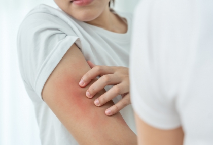 洗完澡「這時間內」擦乳液最保濕!皮膚科醫師認證 很多人都擦太晚