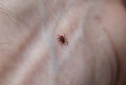 北部爆SFTS病例！70歲男發燒、全身無力確診  疾管署：住家周邊採獲16隻蜱蟲