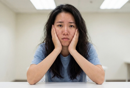 氣血不足怎麼看？中醫揭「5徵兆」自測  中3項就要注意